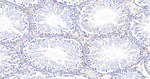 FBXO5 Antibody in Immunohistochemistry (Paraffin) (IHC (P))