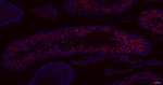 FBXO5 Antibody in Immunohistochemistry (Paraffin) (IHC (P))
