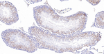 FBXO5 Antibody in Immunohistochemistry (Paraffin) (IHC (P))