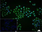TBLR1 Recombinant Rabbit Monoclonal Antibody (6A2)