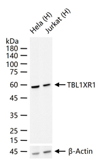 TBLR1 Antibody in Western Blot (WB)