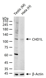 CHD1L Recombinant Rabbit Monoclonal Antibody (9H4)