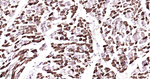 PEN2 Recombinant Rabbit Monoclonal Antibody (3D19)