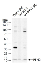 PEN2 Antibody in Western Blot (WB)