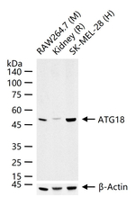 WIPI1 Recombinant Rabbit Monoclonal Antibody (1A3)