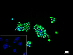 HMGA1 Recombinant Rabbit Monoclonal Antibody (4F11)