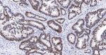 HMGA1 Antibody in Immunohistochemistry (Paraffin) (IHC (P))