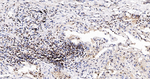 HMGA1 Antibody in Immunohistochemistry (Paraffin) (IHC (P))