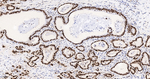HMGA1 Antibody in Immunohistochemistry (Paraffin) (IHC (P))