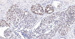 HMGA1 Antibody in Immunohistochemistry (Paraffin) (IHC (P))