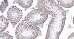 HMGA1 Antibody in Immunohistochemistry (Paraffin) (IHC (P))