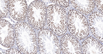 HMGA1 Antibody in Immunohistochemistry (Paraffin) (IHC (P))