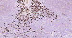Human IgG2 Antibody in Immunohistochemistry (Paraffin) (IHC (P))