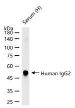 Human IgG2 Antibody in Western Blot (WB)