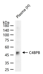 C4BPB Antibody in Western Blot (WB)