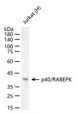 p40 Recombinant Rabbit Monoclonal Antibody (1C5)