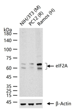 eIF2A Antibody in Western Blot (WB)