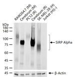 SIRP alpha Recombinant Rabbit Monoclonal Antibody (19H5)