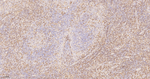 ADAP Antibody in Immunohistochemistry (Paraffin) (IHC (P))