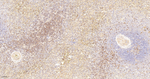 ADAP Antibody in Immunohistochemistry (Paraffin) (IHC (P))