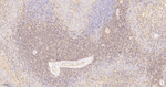 ADAP Antibody in Immunohistochemistry (Paraffin) (IHC (P))