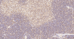 ADAP Antibody in Immunohistochemistry (Paraffin) (IHC (P))