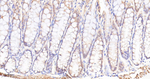 PP1 beta Antibody in Immunohistochemistry (Paraffin) (IHC (P))