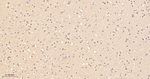 PP1 beta Antibody in Immunohistochemistry (Paraffin) (IHC (P))