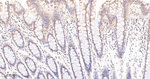 PP1 beta Recombinant Rabbit Monoclonal Antibody (18D12)
