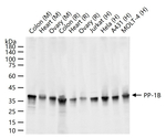 PP1 beta Antibody in Western Blot (WB)