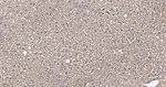 FBP1 Antibody in Immunohistochemistry (Paraffin) (IHC (P))