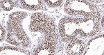 SRSF3 Antibody in Immunohistochemistry (Paraffin) (IHC (P))