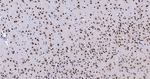 SRSF3 Antibody in Immunohistochemistry (Paraffin) (IHC (P))