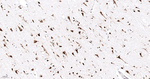 SRSF3 Antibody in Immunohistochemistry (Paraffin) (IHC (P))
