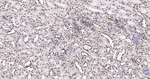 SRSF3 Antibody in Immunohistochemistry (Paraffin) (IHC (P))
