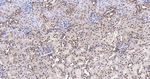 SRSF3 Antibody in Immunohistochemistry (Paraffin) (IHC (P))