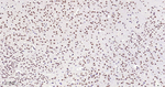 METTL3 Antibody in Immunohistochemistry (Paraffin) (IHC (P))