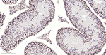 METTL3 Antibody in Immunohistochemistry (Paraffin) (IHC (P))