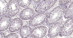 METTL3 Antibody in Immunohistochemistry (Paraffin) (IHC (P))