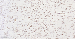METTL3 Antibody in Immunohistochemistry (Paraffin) (IHC (P))
