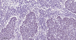 METTL3 Antibody in Immunohistochemistry (Paraffin) (IHC (P))