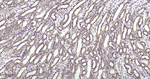 METTL3 Antibody in Immunohistochemistry (Paraffin) (IHC (P))