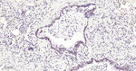 METTL3 Antibody in Immunohistochemistry (Paraffin) (IHC (P))