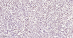METTL3 Recombinant Rabbit Monoclonal Antibody (3E10)