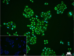 HIPK2 Recombinant Rabbit Monoclonal Antibody (5E7)