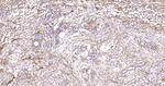 Fibronectin Antibody in Immunohistochemistry (Paraffin) (IHC (P))