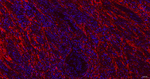 Fibronectin Antibody in Immunohistochemistry (Paraffin) (IHC (P))