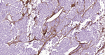 Fibronectin Antibody in Immunohistochemistry (Paraffin) (IHC (P))