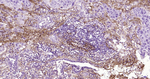Fibronectin Antibody in Immunohistochemistry (Paraffin) (IHC (P))