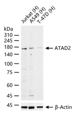 ATAD2 Antibody in Western Blot (WB)